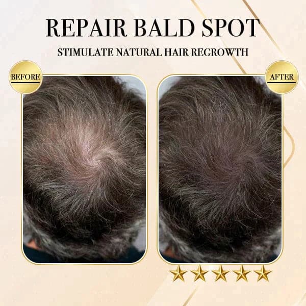 Ginger Cold Processed Hair Regrowth Shampoo Bar 1+1 (2 pcs)