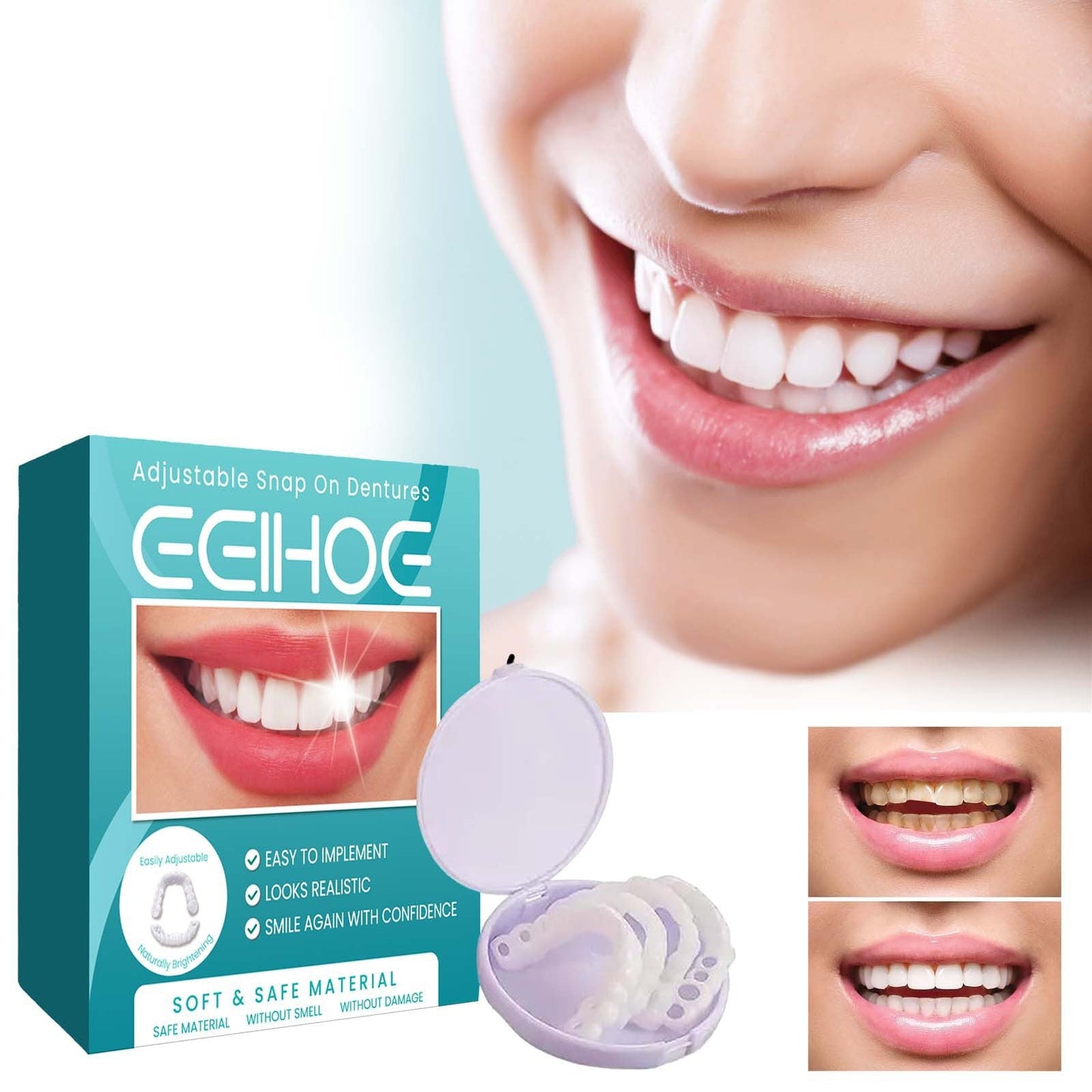💝Last day discount-60%Off💝Latest👨⚕Adjustable Snap-On Dentures😁