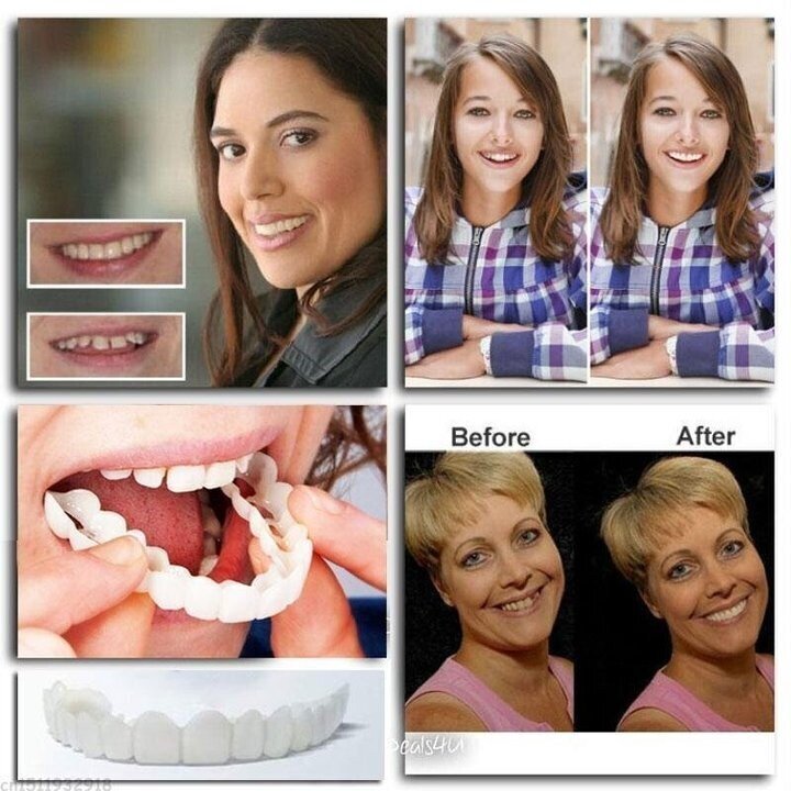 💝Last day discount-60%Off💝Latest👨⚕Adjustable Snap-On Dentures😁