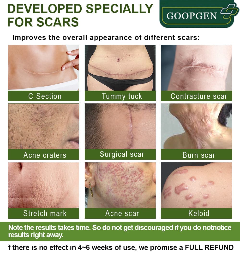 GOOPGEN™ Advanced Scar Repair Serum For All Types of Scars - Especially Acne Scars, Surgical Scars and Stretch Marks