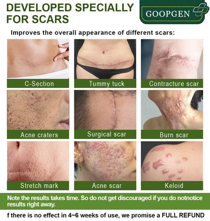 GOOPGEN™ Advanced Scar Repair Serum For All Types of Scars - Especially Acne Scars, Surgical Scars and Stretch Marks