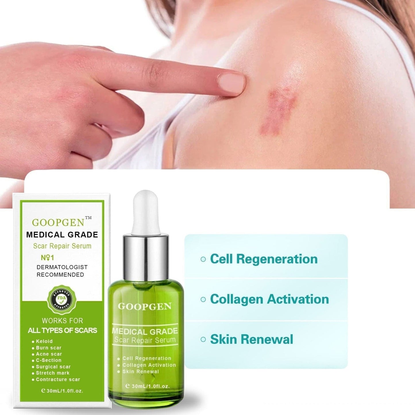 GOOPGEN™ Advanced Scar Repair Serum For All Types of Scars - Especially Acne Scars, Surgical Scars and Stretch Marks