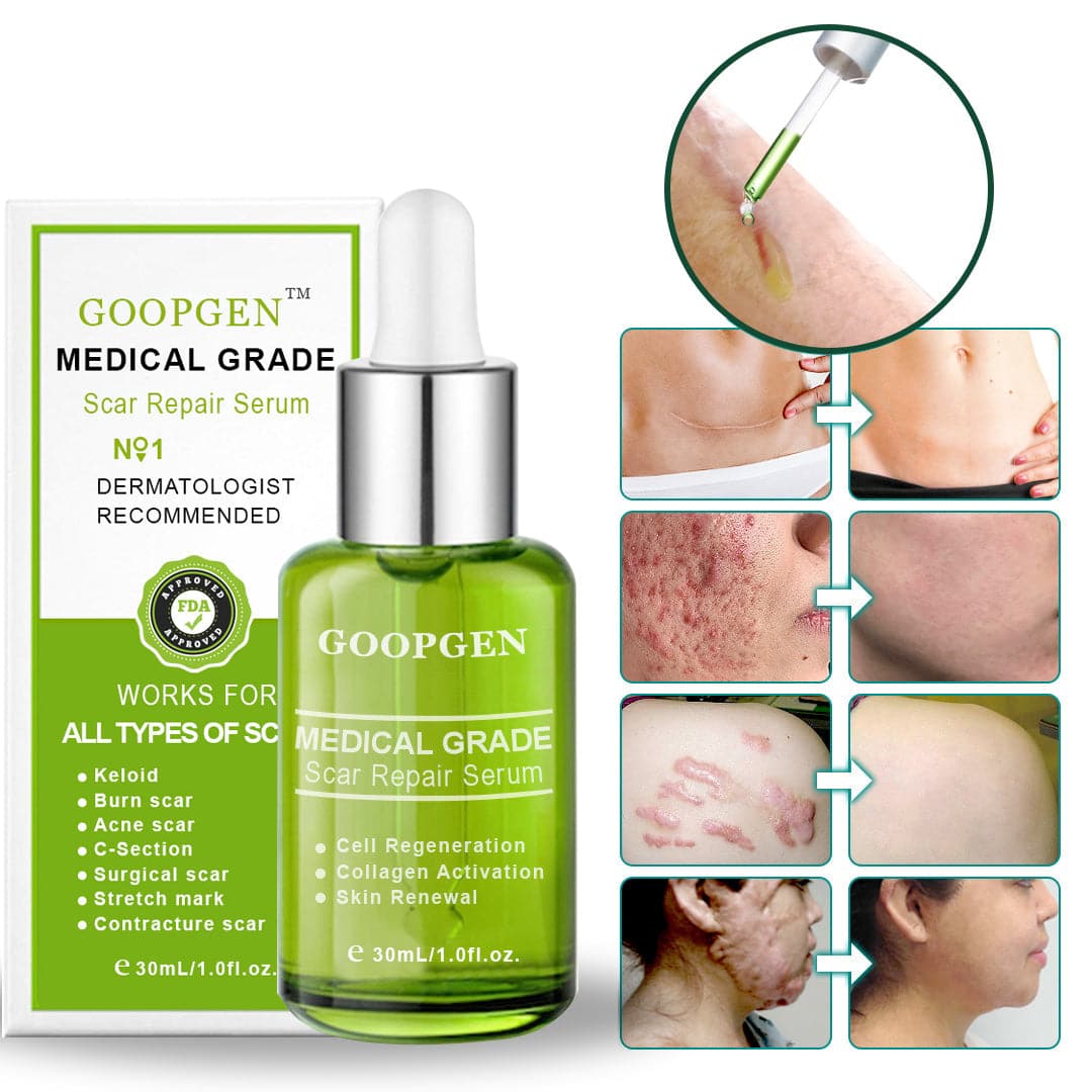 GOOPGEN™ Advanced Scar Repair Serum For All Types of Scars - Especially Acne Scars, Surgical Scars and Stretch Marks