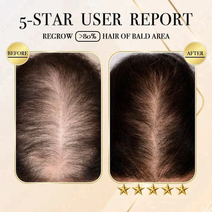 Ginger Cold Processed Hair Regrowth Shampoo Bar 1+1 (2 pcs)